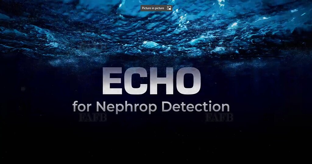 Echo for Prawn Detection
